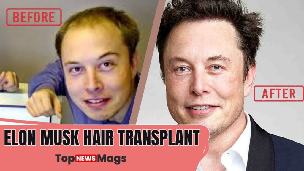Elon Musk Hair
